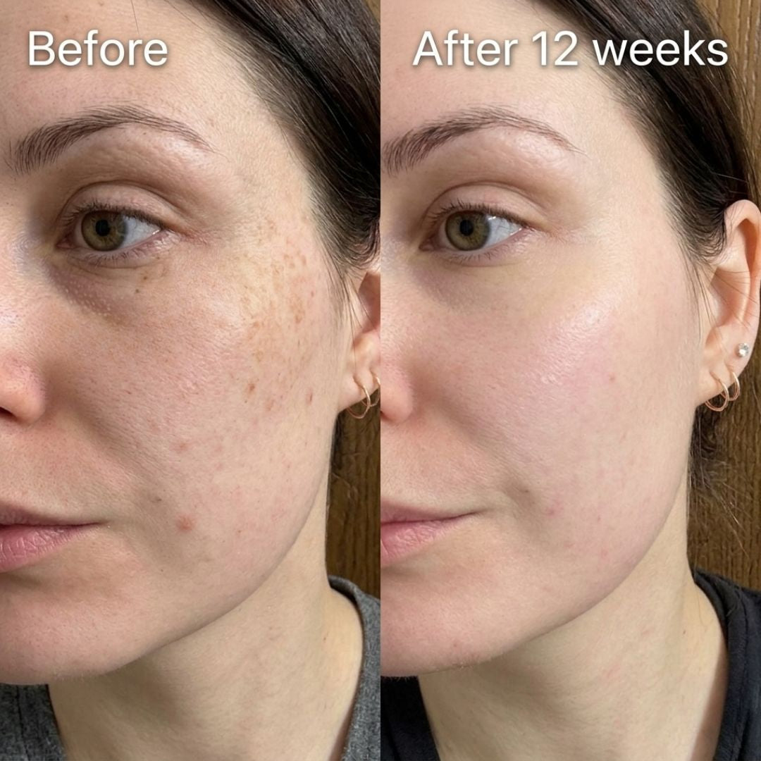 LED Facial Rejuvenation Device – Anti-Aging Skin Therapy | Rayvva