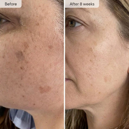 LED Facial Rejuvenation Device – Anti-Aging Skin Therapy | Rayvva